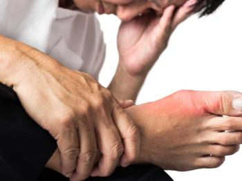 Gut artriti şikâyetlerinin hafifletilmesinde yararlanılabilecek bitkisel ürünler